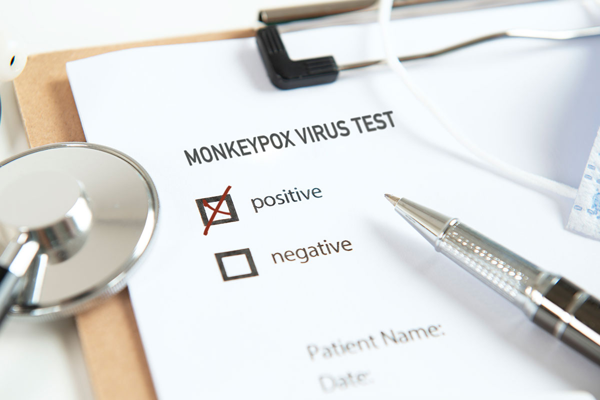 Answers to your most frequently asked monkeypox questions