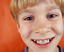 Dental 